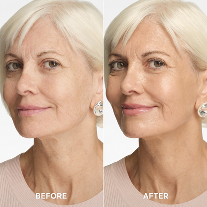 🔥Last Day 49% OFF-Mirevyn Collagen Tinted Moisturizer